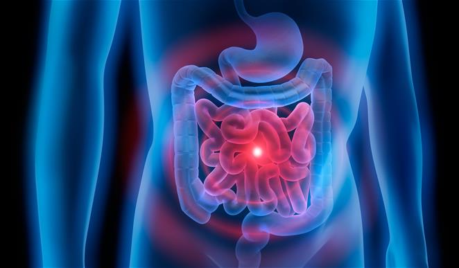 What Is Gut Health? Why Is It Important? - Gut Health