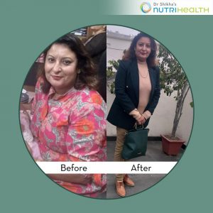 Weight Loss Story of Sonal: Lost Almost 16 kgs in 5 months