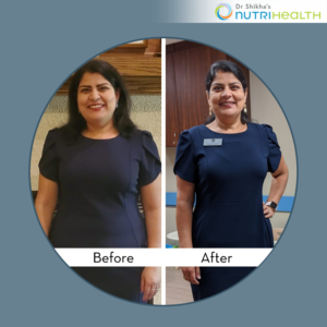 Improved my gut health which helped in overall well being: Khushali